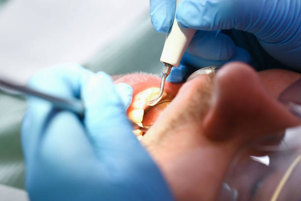 Best Weekend Emergency Dentist in New Canaan, CT