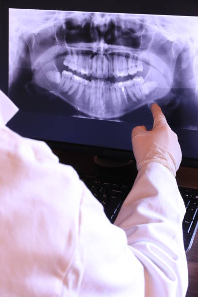 Best Emergency Dentist for Lost Fillings or Crowns in New Canaan, CT