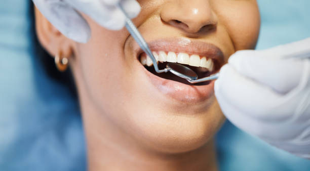 Best Broken or Cracked Tooth Emergency Dentist in New Canaan, CT